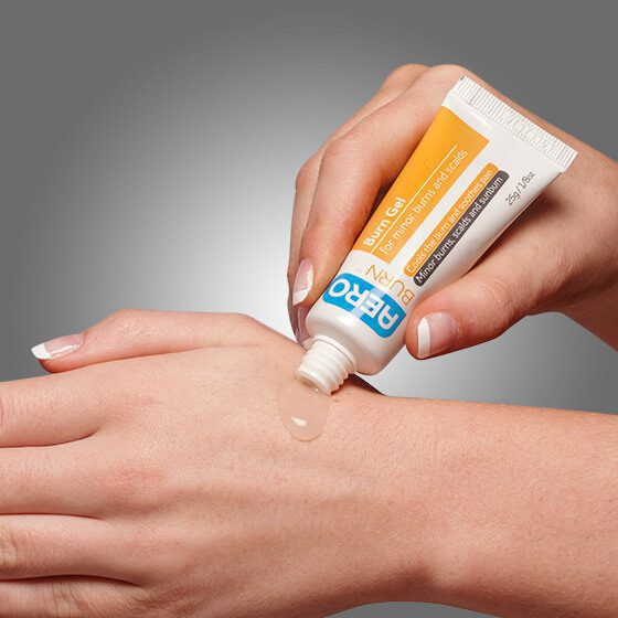 AEROBURN Burn Gel Tube 50g 36 Pack