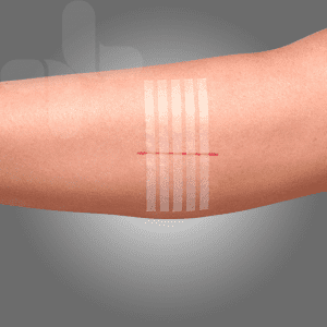 AEROPLAST Wound Closure Strips 3 x 75mm Box of 50 (5 strips/card)